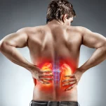 Spinal Stenosis From a Car Accident
