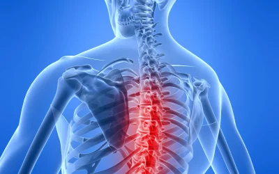 Spinal Fracture Accidents in Colorado